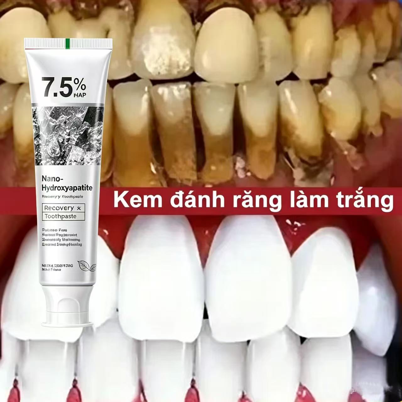Teeth Whitening Treatment - 7.5% Hydroxyapatite Probiotic Whitening Toothpaste Enamel
