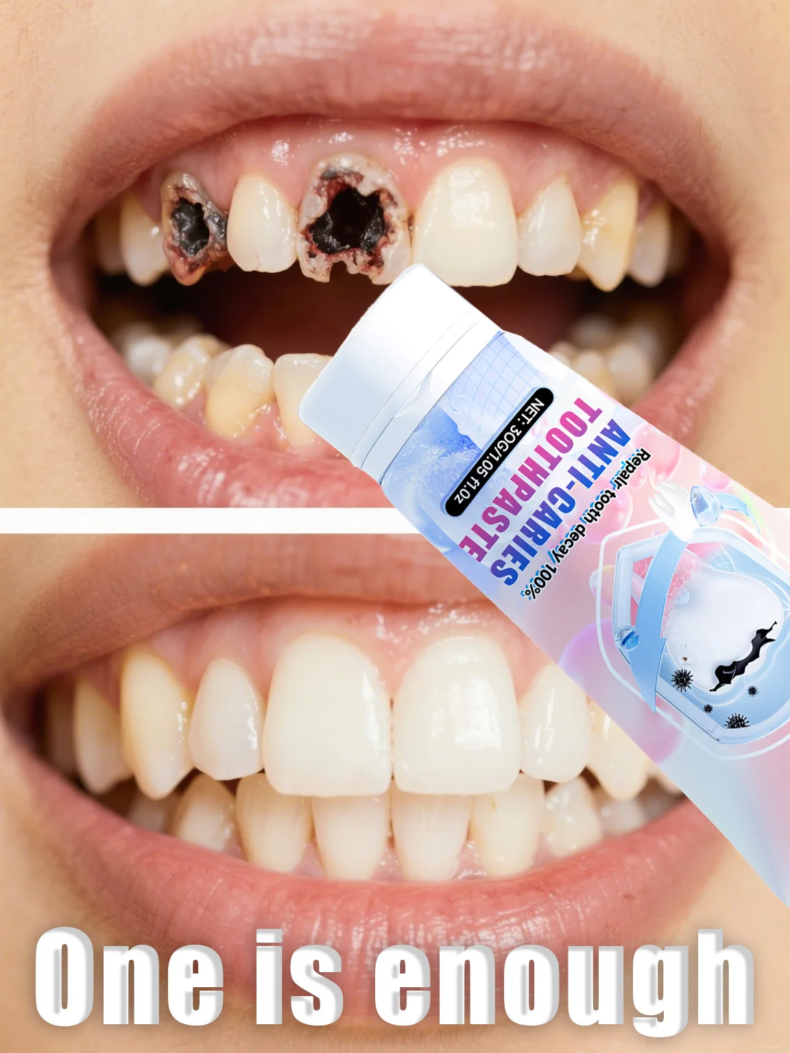 Teeth Whitening Charcoal Powder - ⁹⁹% ᵒᶠ ᵖᵉᵒᵖˡᵉ ʳᵉᵖᵘʳᶜʰᵃˢᵉ ᵗᵒ ʳᵉᵖᵃⁱʳ