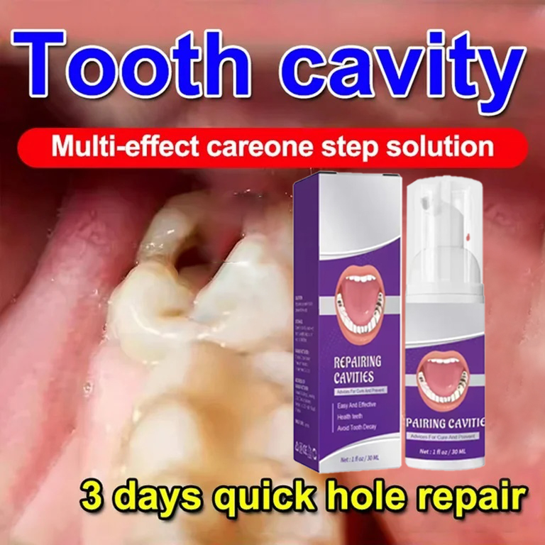 Teeth Whitening Treatment - Teeth Cleaning Toothpaste Removes Tooth Stains