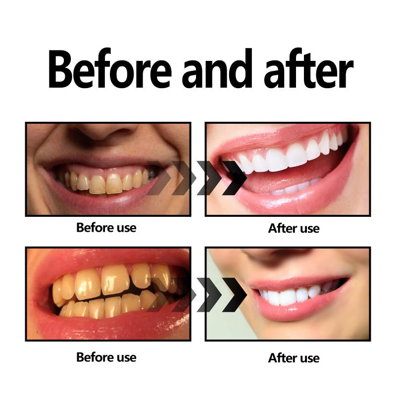 Teeth Whitening Powder Charcoa - Teeth Whitening Charcoal Powder review and price