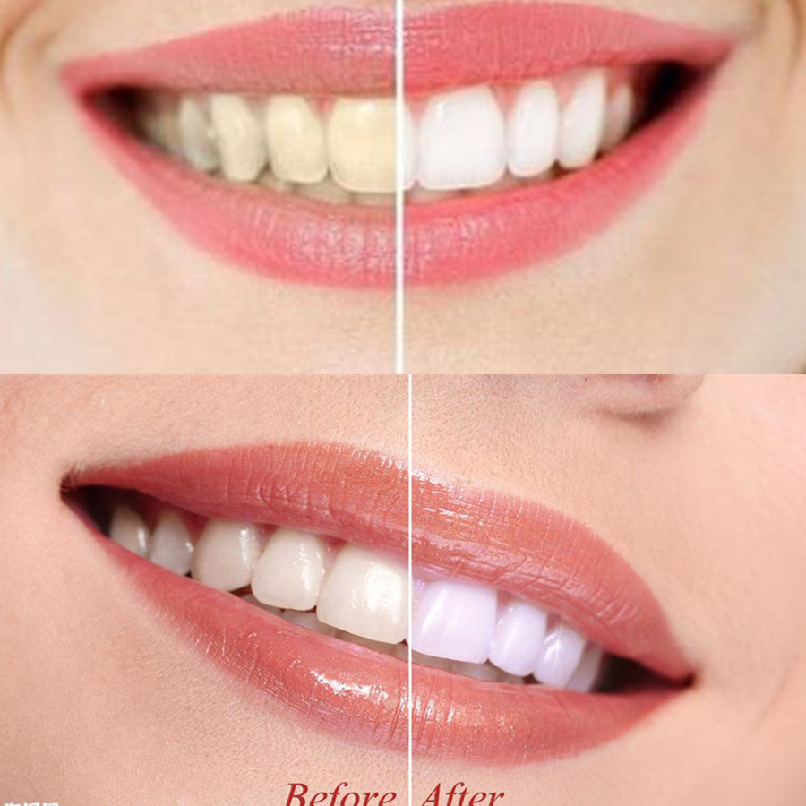 Bamboo Charcoal Teeth Tooth De - Teeth Whitening Charcoal Powder review and price