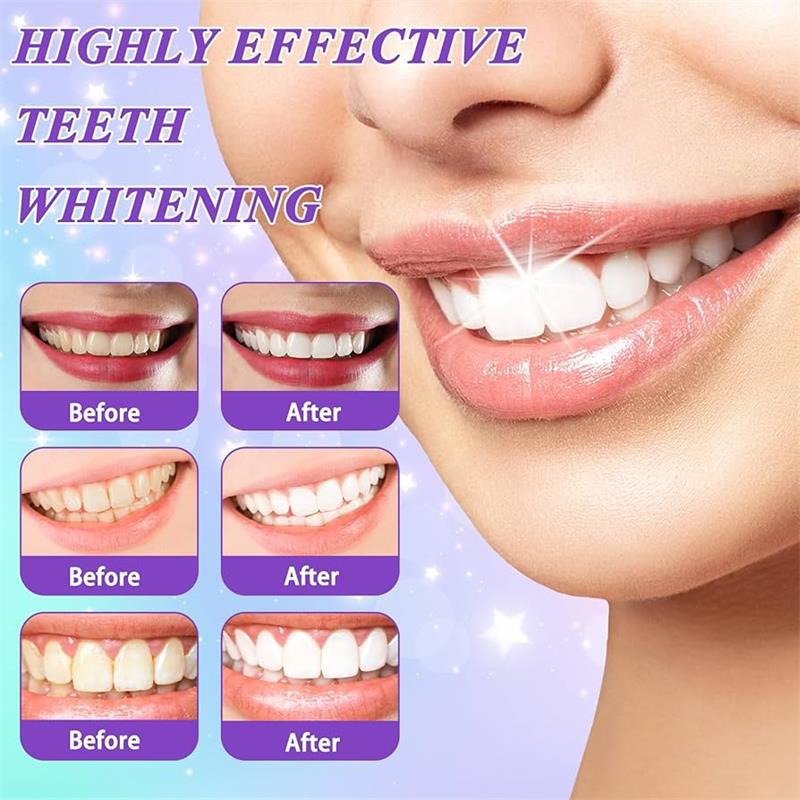 9D Purple Teeth Whitening Toot - Teeth Whitening Treatment review and price