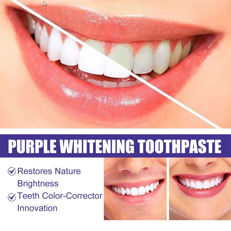 9D Purple Teeth Whitening Toot - Teeth Whitening Treatment review and price