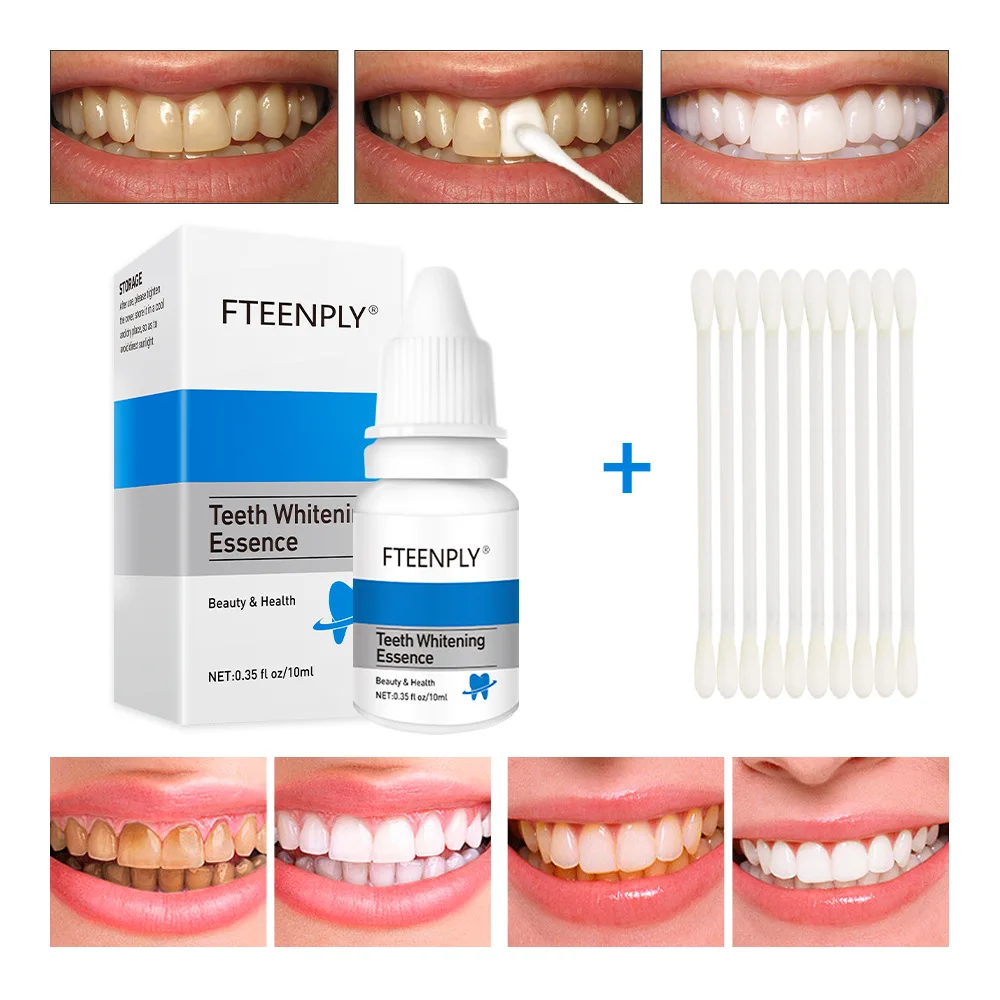 FTEENPLY Teeth Whitening Essen - Teeth Whitening Street review and price