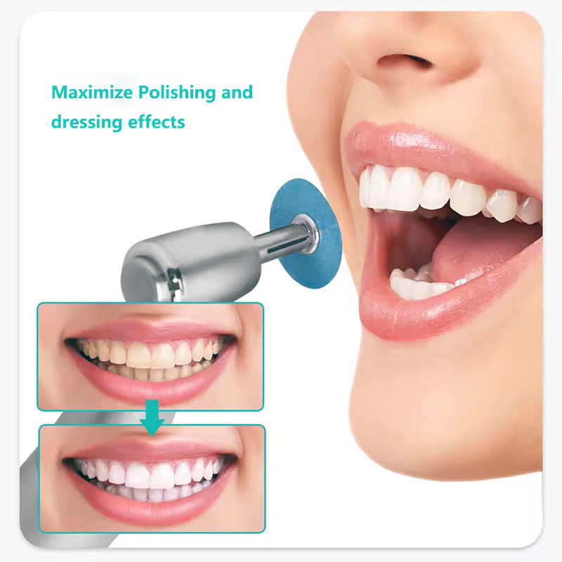 40pcs Dental Polishing Discs H - Teeth Whitening Kit Professional review and price