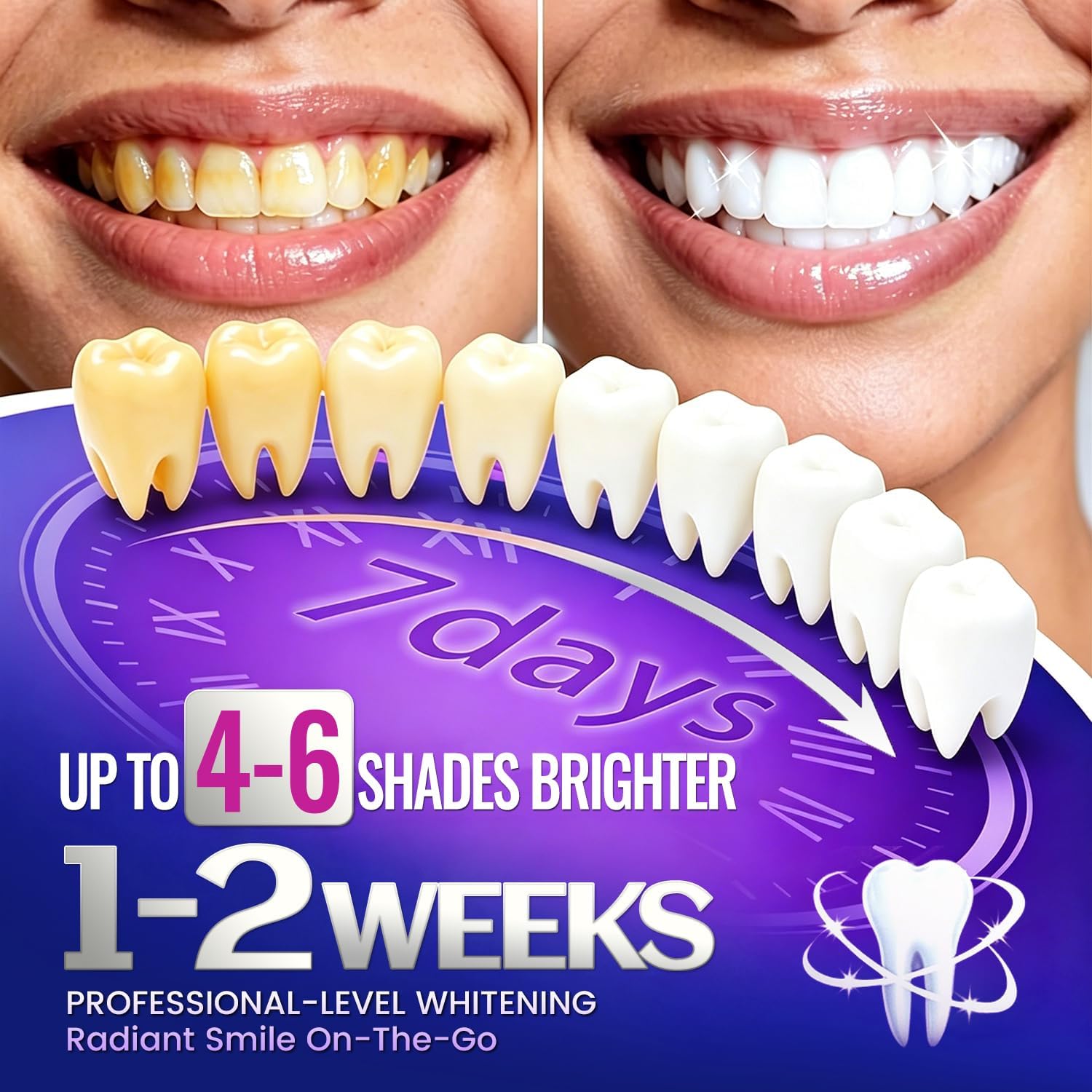 1/7 Pairs Teeth Whitening Stri - Teeth Whitening Street review and price