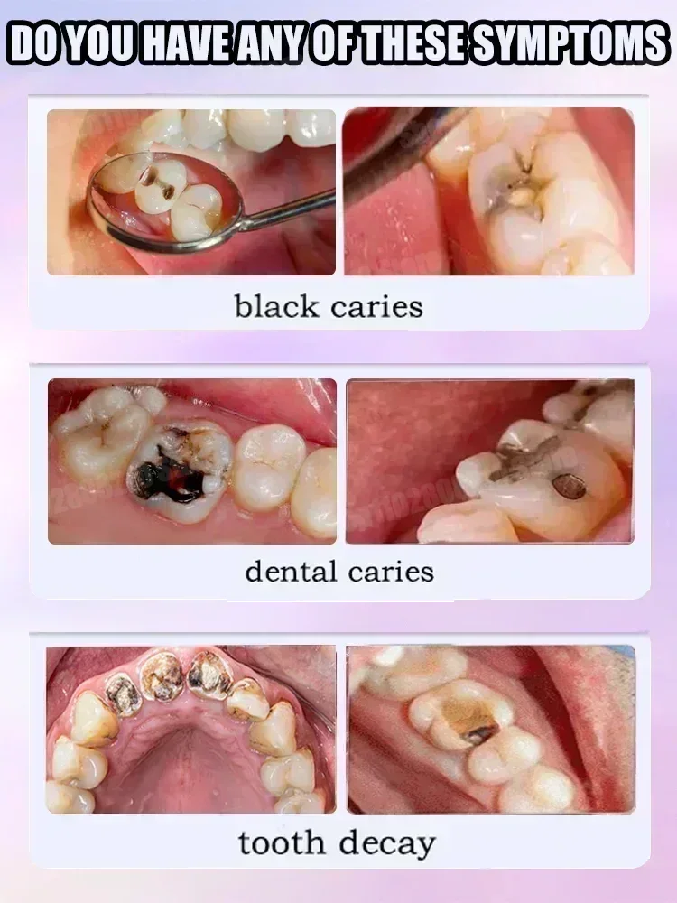 Teeth Cleaning Toothpaste Remo - Teeth Whitening Treatment review and price
